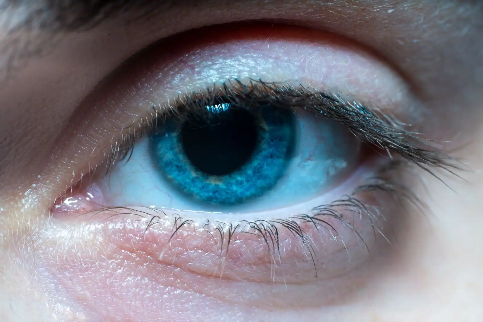 Gros plan sur l'œil et le bord de la paupière d'une personne, la zone où se forme un orgelet.